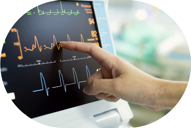 ECG image